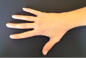 Øvelse 6 spred fingrene strakte