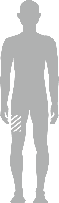 Viser raceringsområde: Felt midt på højre lår