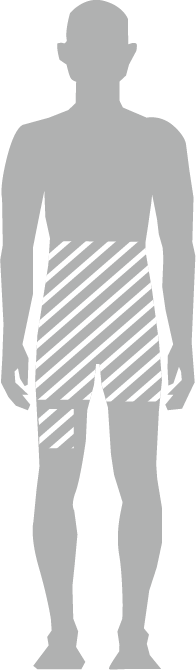 Viser raceringsområde: Kønsbehåring samt midt på højre lår