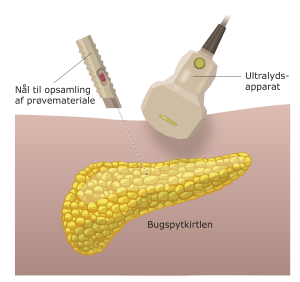 Vævsprøve bugspytkirtlen.png