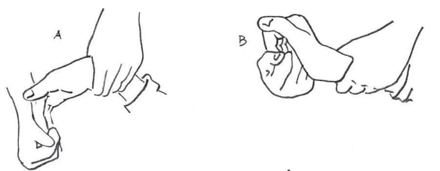 Tenodesegreb - fingrene bevæges igennem